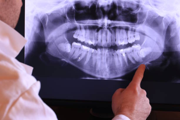 Best Emergency Cosmetic Dentistry in Layhill, MD