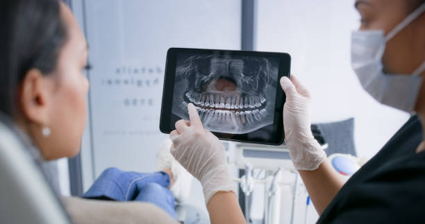Best Emergency Root Canal Treatment in Layhill, MD